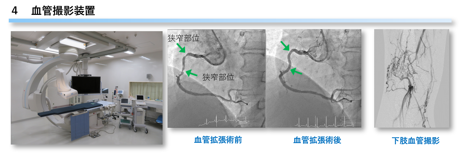 血管撮影装置