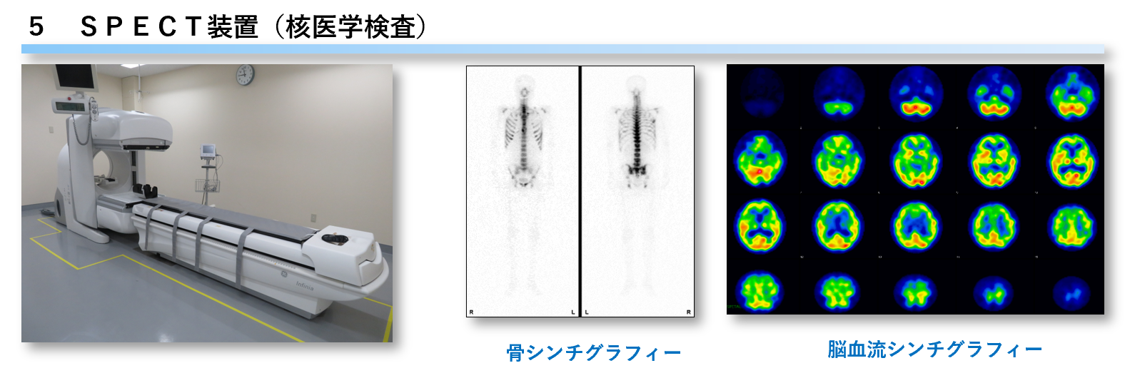 ＳＰＥＣＴ装置（核医学検査）