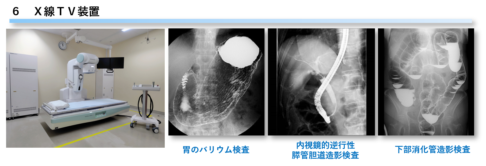 Ｘ線ＴＶ装置